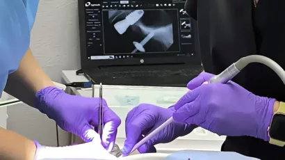 імплантація зубів