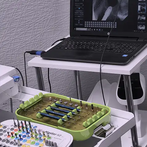 Імплантація зубів - операція