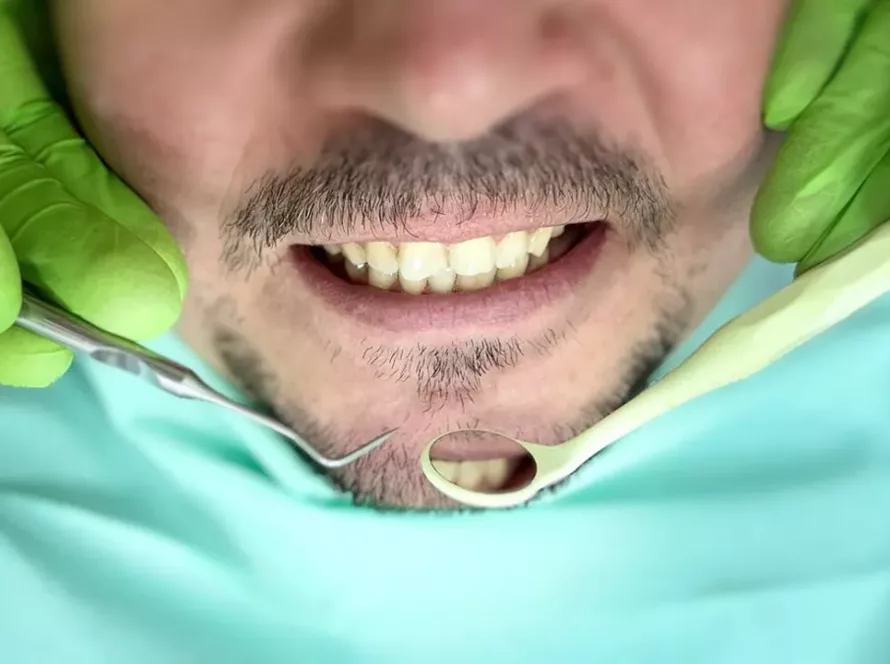 Послуги лікування зубів - Стоматологія Формула 1 в Черкасах