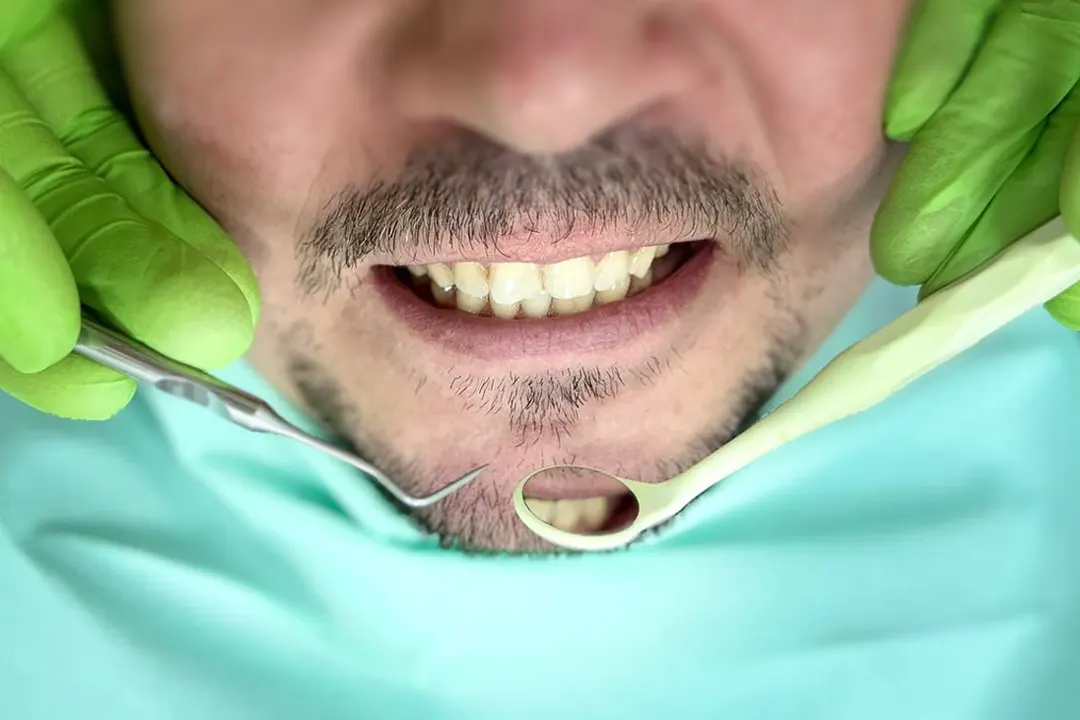 Лікування зубів