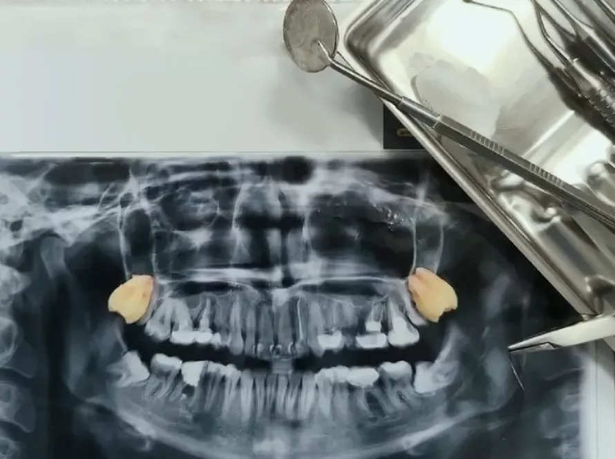 Послуги хірургії в стоматології Формула 1